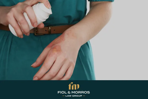 Types of Burn Injuries and Their Severity